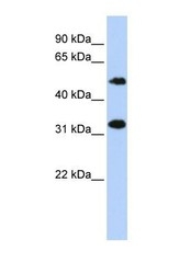 NBP1-70755 - C6orf150