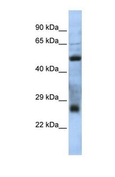 NBP1-70480 - C7orf62