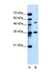 NBP1-60059 - TMEM8B