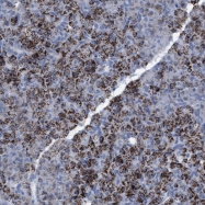 NBP1-85669 - C9orf4