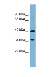 NBP1-59960 - C9orf4