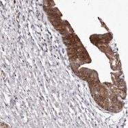 NBP1-88241 - Mucin-16 / CA125