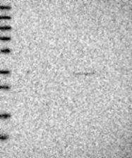 NBP1-86654 - Carbonic anhydrase 8