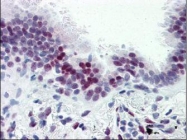 NBP1-50297 - CASZ1