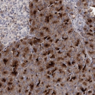 NBP1-86618 - CASZ1