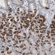 NBP1-86599 - CBLB / RNF56
