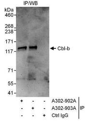 NBP1-49919 - CBLB / RNF56