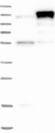 NBP1-86599 - CBLB / RNF56