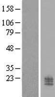 NBL1-08775 - CCDC126 Lysate