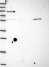 NBP1-93507 - CCDC151