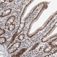 NBP1-88164 - ZNF830 / CCDC16