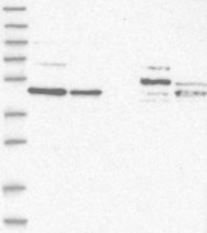 NBP1-88164 - ZNF830 / CCDC16