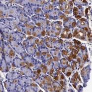NBP1-84331 - CCDC22