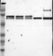 NBP1-84331 - CCDC22