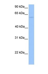 NBP1-56939 - CCT6B / TCP1 zeta-2