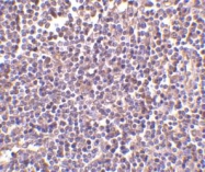 NBP1-76700 - CD5L / API6
