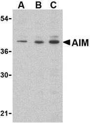 NBP1-76699 - CD5L / API6