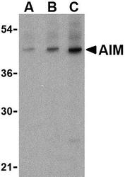 NBP1-76700 - CD5L / API6