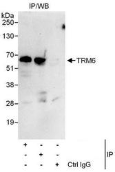 NBP1-50039 - TRMT6