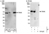 NBP1-50040 - TRMT6