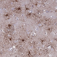 NBP1-91783 - Neuronal acetylcholine receptor subunit beta-3