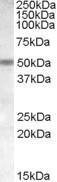 NB100-94886 - Neuronal acetylcholine receptor subunit beta-3