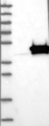NBP1-84474 - WDR39 / CIAO1