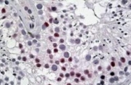 NBP1-52123 - TSPYL2