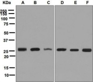 NBP1-96007 - CLPP