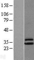 NBL1-09279 - CLPP Lysate