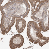 NBP1-91795 - ICMT / PCCMT