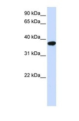 NBP1-69579 - ICMT / PCCMT