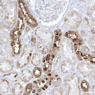 NBP1-88066 - XIRP2 / Beta-Xin