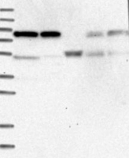 NBP1-88152 - ENOX1 / PIG38