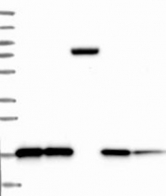 NBP1-91799 - TMEM4 / CNPY2