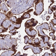 NBP1-88063 - Complex IV subunit III