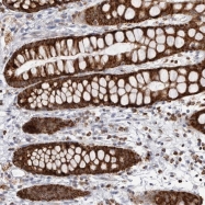 NBP1-86386 - Complex IV subunit Va