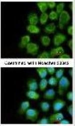 NBP1-32550 - Complex IV subunit Va