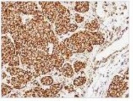 NBP1-32550 - Complex IV subunit Va