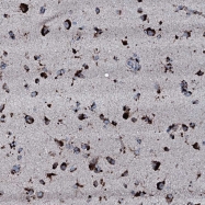 NBP1-91808 - Carboxypeptidase O