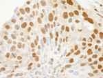 NB100-79802 - XPO1 / Exportin-1