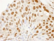 NB100-40862 - XPO1 / Exportin-1