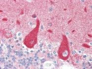 NBP1-50466 - CRMP1 / DPYSL1