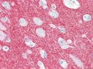 NBP1-50466 - CRMP1 / DPYSL1