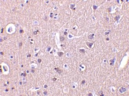 NBP1-76651 - CRMP1 / DPYSL1