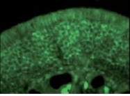 NBP1-18294 - CRMP1 / DPYSL1