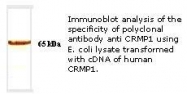 NBP1-18294 - CRMP1 / DPYSL1