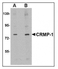 NBP1-50466 - CRMP1 / DPYSL1
