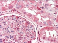 NBP1-50580 - DPYSL2 / CRMP2