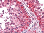 NBP1-50580 - DPYSL2 / CRMP2